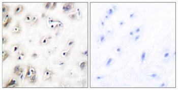 Amylin antibody