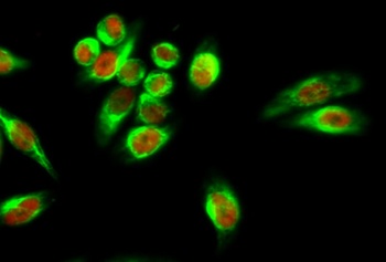 Amyloid-beta antibody