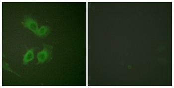 Amyloid-β rabbit pAb
