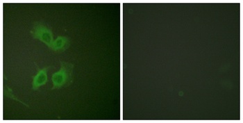 Amyloid-beta antibody