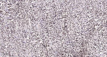 ANKRD30A antibody