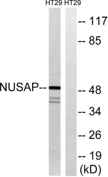 ANKT antibody