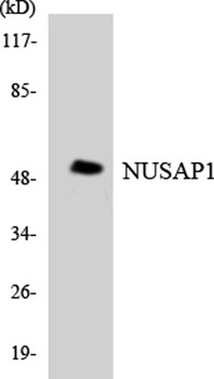 ANKT antibody