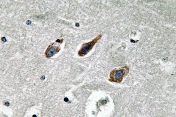 Annexin II rabbit pAb
