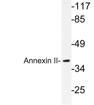 Annexin II antibody