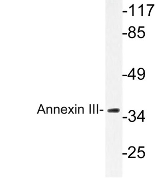Annexin III rabbit pAb