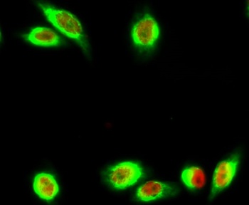 Annexin VI antibody