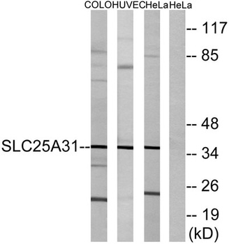 ANT4 antibody