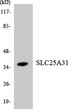 ANT4 antibody