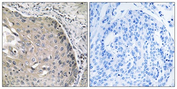 AOX1 antibody