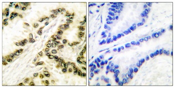 AP-2α/β rabbit pAb