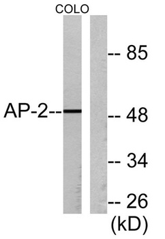 AP-2alpha/beta antibody