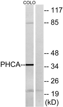APHC antibody
