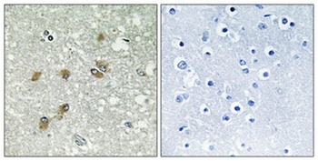 ApoL1 antibody