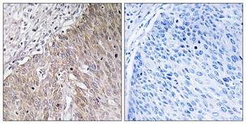 ApoL2 antibody