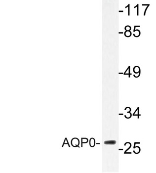 AQP0 antibody