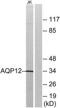 AQP12 rabbit pAb