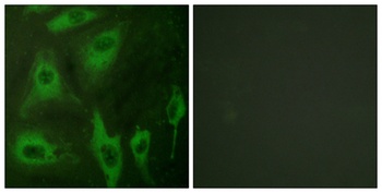 AQP2 antibody