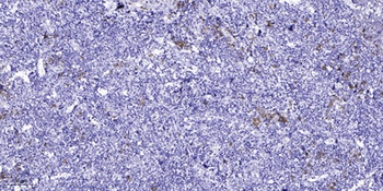 AQP2 rabbit pAb