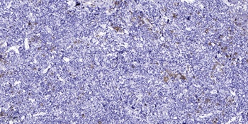 AQP2 antibody