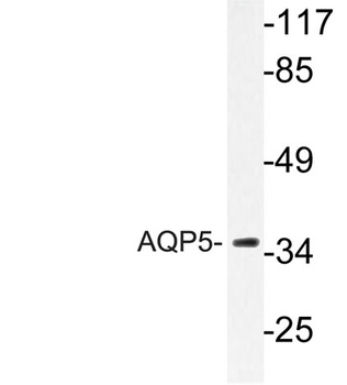 AQP5 rabbit pAb