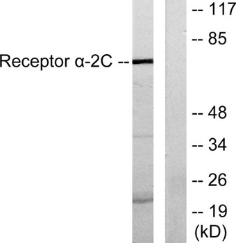 AR alpha2C antibody
