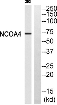 ARA70 antibody