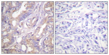 A-Raf antibody