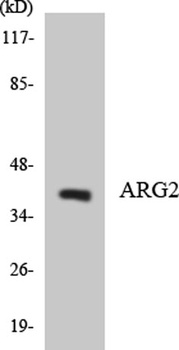 Arginase II rabbit pAb