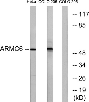 ARMC6 rabbit pAb