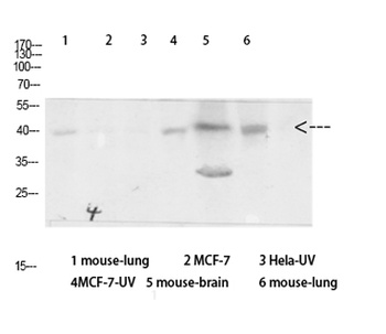 Arrestin-β-1 rabbit pAb