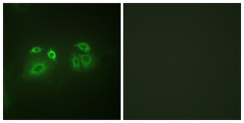 Arrestin-β-1 rabbit pAb