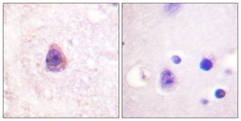 Arrestin-β-1 rabbit pAb