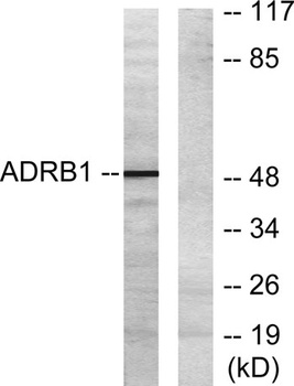 AR-β1 rabbit pAb
