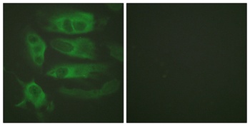 AR-β2 rabbit pAb