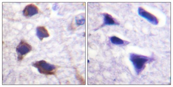 AR-β2 rabbit pAb