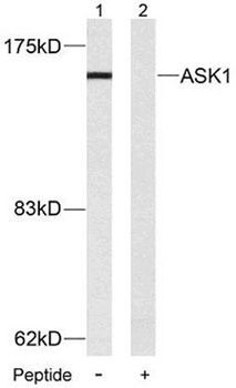 ASK 1 antibody