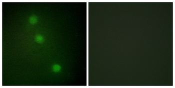 ATF-1 antibody