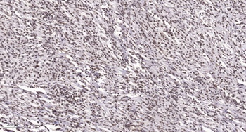 ATF-7 rabbit pAb