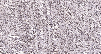 ATF-7 antibody