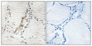 ATP5C1 rabbit pAb