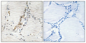 ATP5C1 antibody