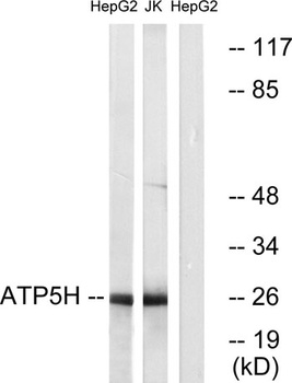 ATP5H rabbit pAb