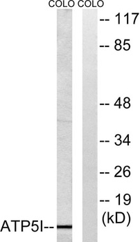 ATP5I rabbit pAb Antibody