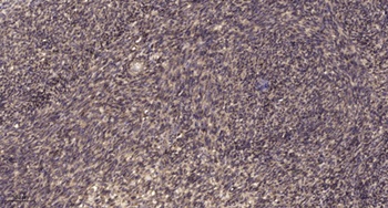 ATP5I rabbit pAb Antibody