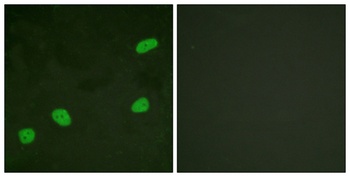 ATRIP antibody