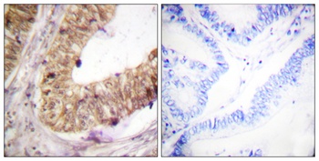 ATRIP antibody