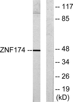 AW-1 antibody