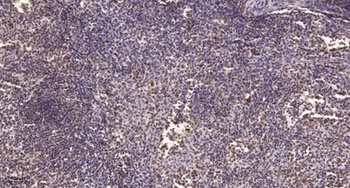 AW-1 antibody