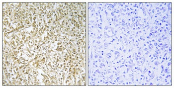 BARD1 antibody